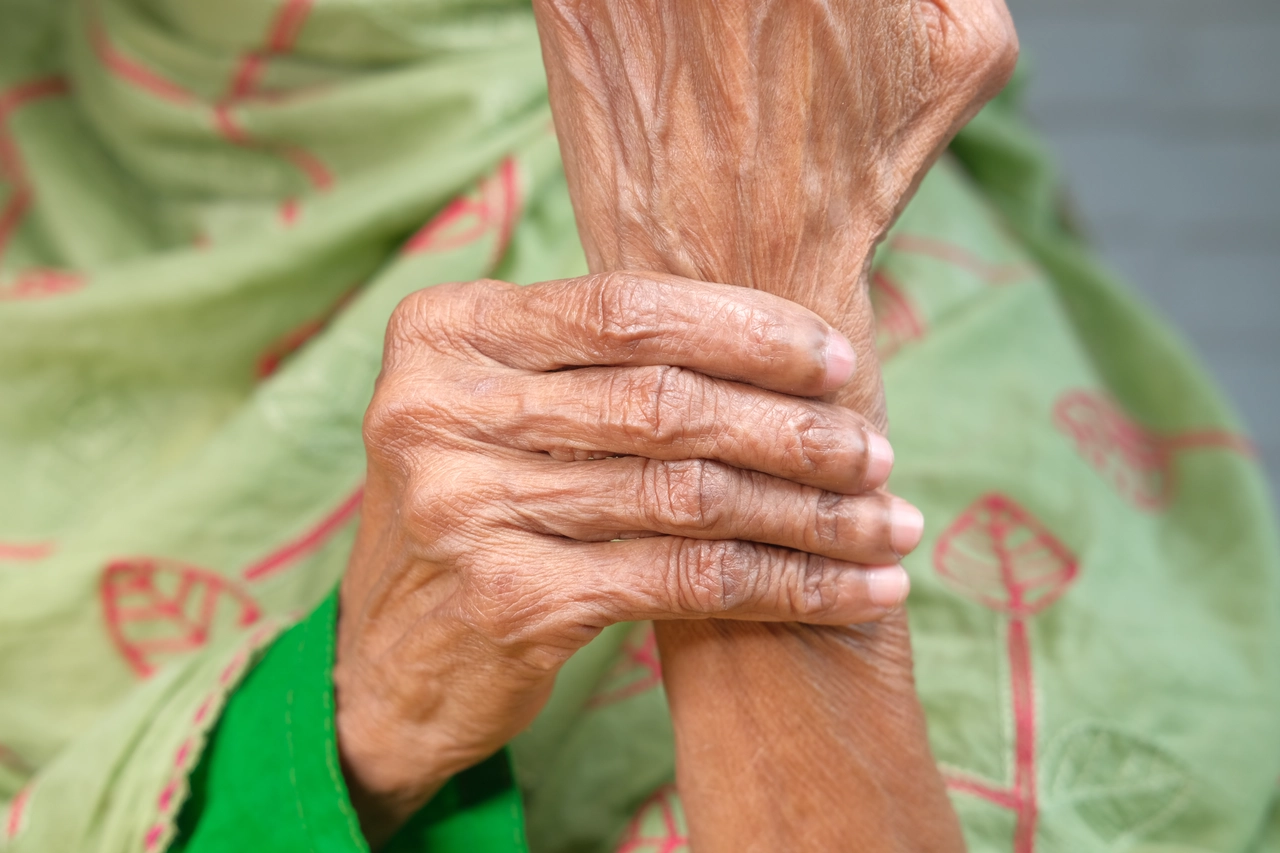 Non ignorare questi sintomi comuni: potrebbero indicare una forma grave di artrite infiammatoria